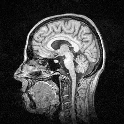 Original grayscale head image